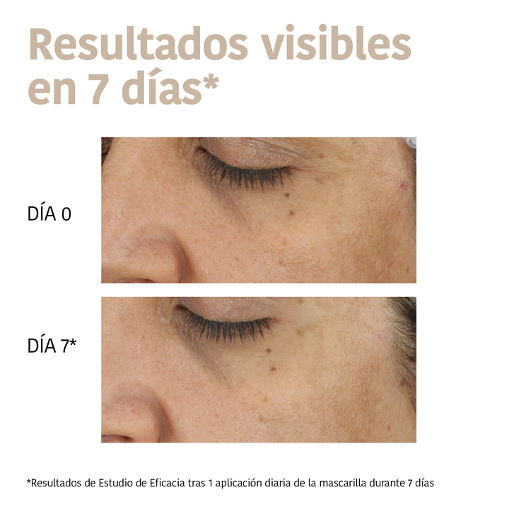 Mascarilla Facial Antimanchas con Ácido Tranexámico