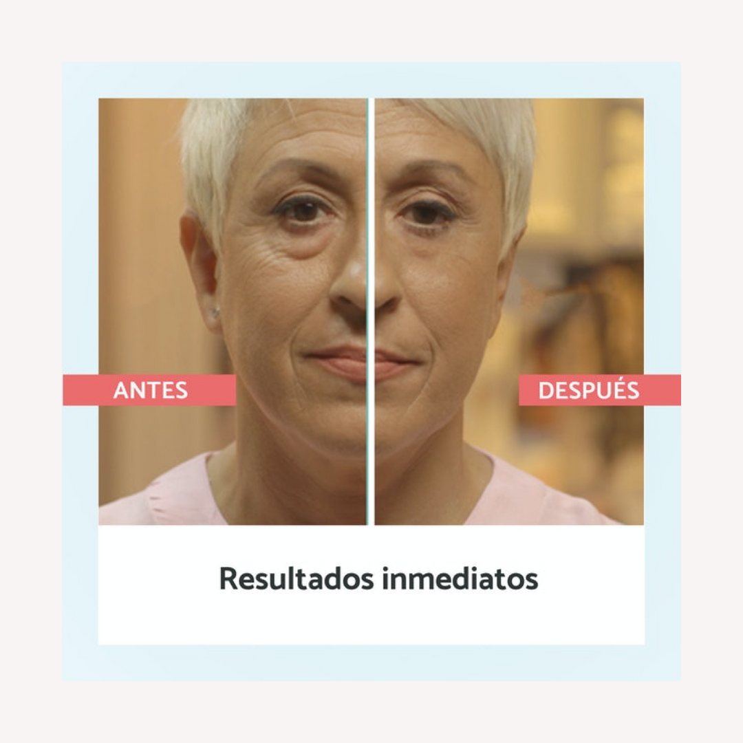 Remescar Bolsas y Ojeras Reducción Instantánea