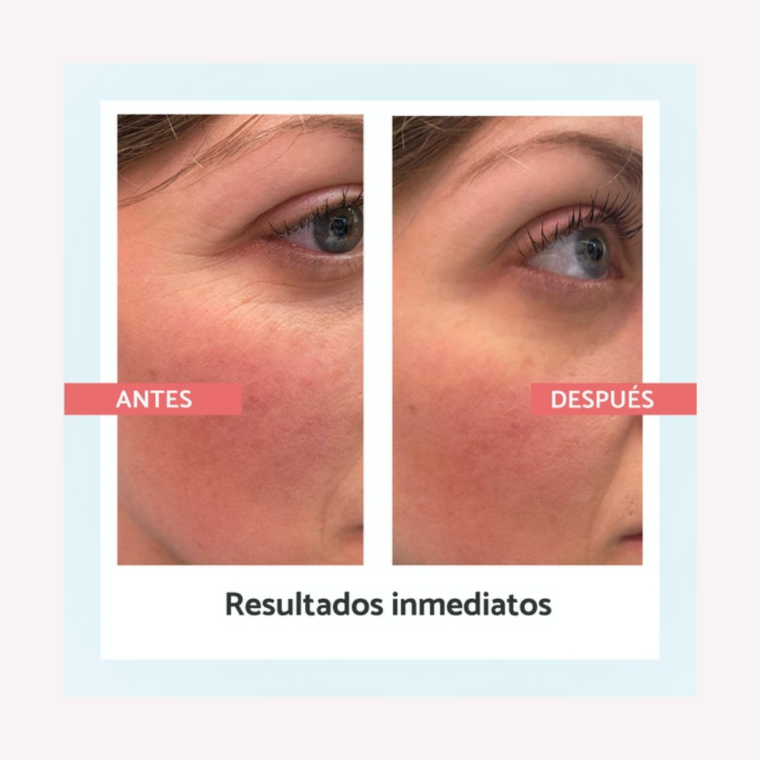 Remescar Corrector Arrugas Piel Lisa Instantánea